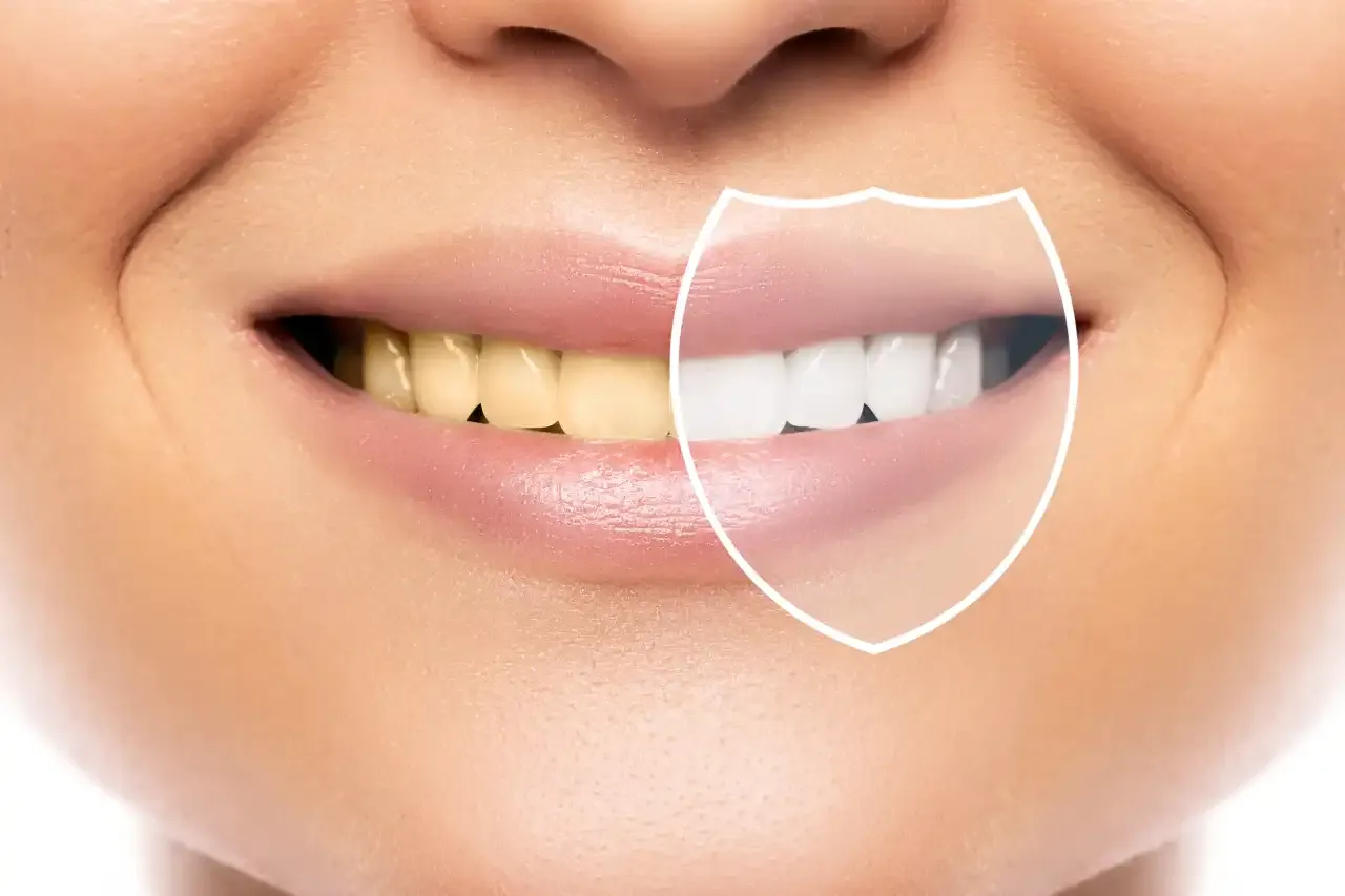 beautiful-female-smile-teeth-whitening-hygiene-result-after-treatment-professional-dental-clinic