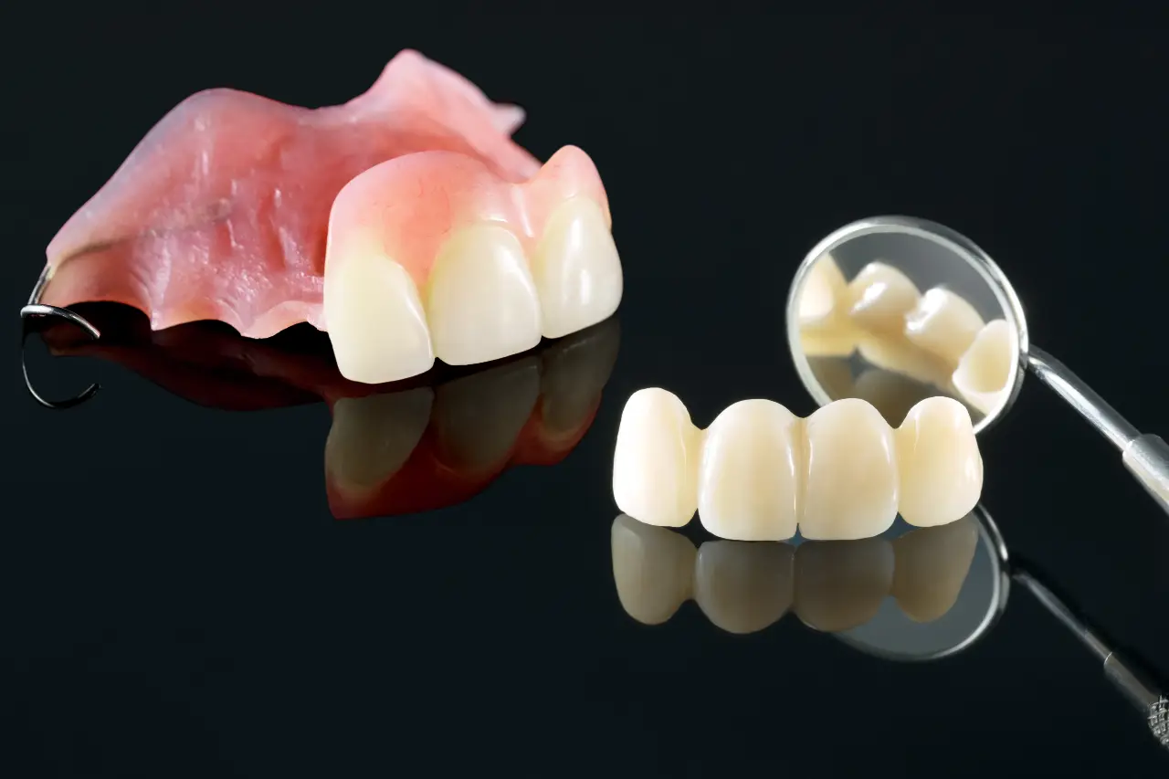 porselen diş seçenekleri