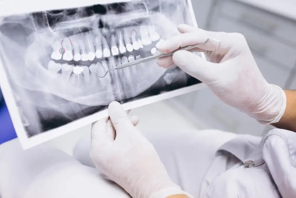 tooth implant process