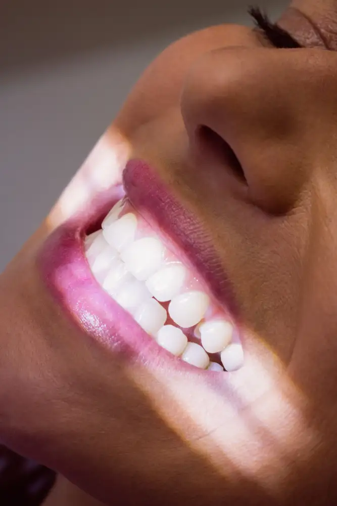 Zirkonyum Diş Estetiği Nedir